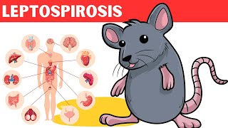 Leptospirosis  Causes Risk Factors Pathology Signs amp Symptoms Diagnosis And Treatment [upl. by Orin918]