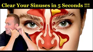 Clear Your Sinuses And Beat Sinusitis Sickness And Allergies In Just 5 Seconds [upl. by Siramed]