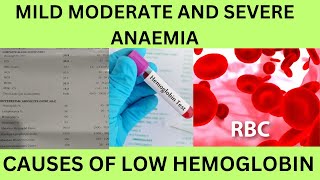 LOW HBHEMOGLOBINCAUSES SYMPTOMSCLASSIFICATION OF ANEMIAMILD MODERATE AND SEVERE ANAEMIA [upl. by Alisa]