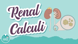 Renal Calculi AKA quotKidney Stonesquot  MedSurg Help for Nursing Students [upl. by Allets]