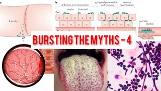 Bursting the myths4 Bursting wrong Antimicrobial practicesCandidaInvasive candidiasisCandidemia [upl. by Oicnedurp801]