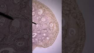 2402 Lab Ovary 1 Histology [upl. by Hsiekal]