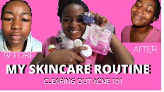 Skincare Routine  After the Duac Gel experience  Skincare [upl. by Karalynn874]