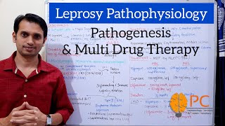 Leprosy Hansens Disease Part 2 Pathophysiology Leprosy Reaction and Multi Drug Therapy [upl. by Hildie796]