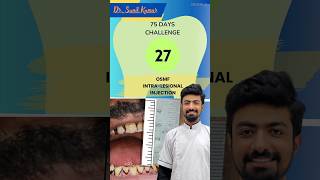 2775 Days Challenge 75dayshardchallenge dentist singledaydentistry dentalclinic [upl. by Haslett]