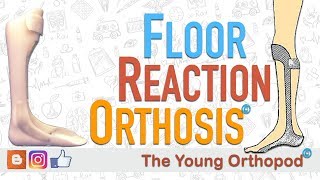 Floor Reaction Orthosis FRO [upl. by Katha721]