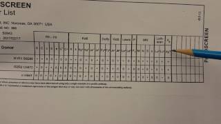 Blood Banking Antibody Screen Setup Part 2 [upl. by Htebizile]