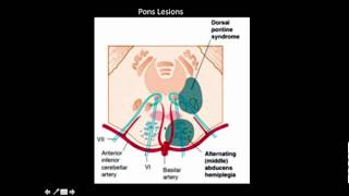 Where is the lesion Part 3 [upl. by Tennek]