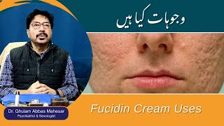 Contractubex Gel Uses in Urdu  Acne Scars Removal Gel  How To Use Contractubex Gel [upl. by Sherrer]