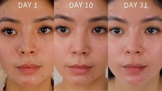 SKINCARE ROUTINE ZO SKIN HEALTH ONE MONTH RESULTS [upl. by Isdnyl]