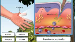 Questce que la réaction inflammatoire [upl. by Neelasor]