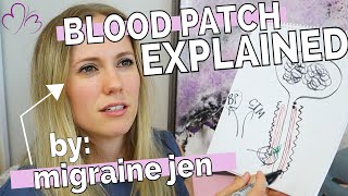 What is a BLOOD PATCH  Showing Why Im Getting 3 of Them prepatch symptoms caught on camera [upl. by Xad]