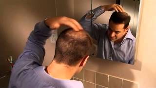 Hair Thickening Product Demo Nanogen Keratin Hair Fibres [upl. by Thurlough405]