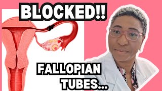 quotClearing the Path to Pregnancy Understanding the Causes of Blocked Fallopian Tubesquot [upl. by Anahsohs]