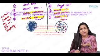 ACUTE LYMPHOBLASTIC LEUKAEMIA By Dr Illa jain khandelwal Pathology by Marrow Video Lacture [upl. by Orvan]