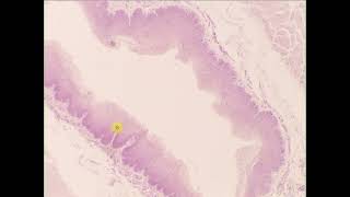 Stratified squamous epithelium non keratinized Esophagus [upl. by Nallak]