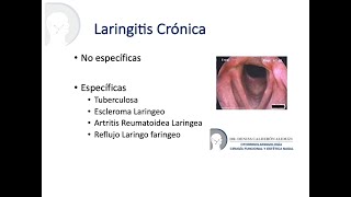 4 Laringitis crónica [upl. by Ydurt701]