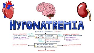 An Approach to Hyponatremia  Hyponatremia Diagnostic Algorithm  Hyponatremia Causes MADE EASY [upl. by Ehrlich]