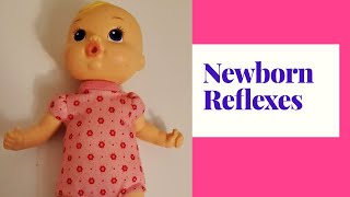 Neonatal Reflex  Moro Reflex  Pediatrics [upl. by Alexi520]