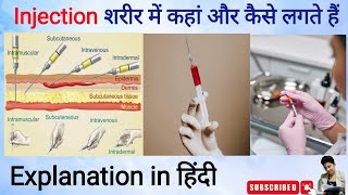 injection I injection kaise lagate hain I injection kahan lagate hain I sites of injection in hindi [upl. by Pulchi]