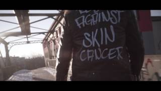 REBEL AGAINST SKIN CANCER Campaign Teaser [upl. by Grimaud889]