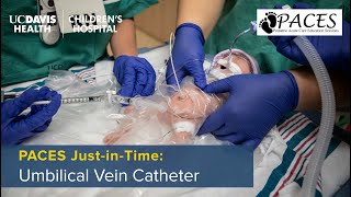 PACES JustinTime Umbilical Venous Catheter UVC Placement [upl. by Attiuqehs]