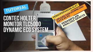 TUTORIAL PENGGUNAAN CONTEC HOLTER MONITOR TLC5000 DYNAMIC ECG SYSTEM [upl. by Ahset244]