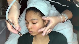 esthetician in training giving my first microdermabrasion [upl. by Dis]