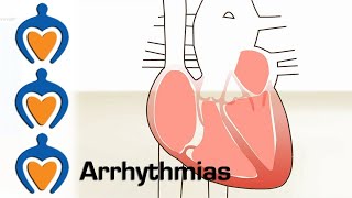 Arrhythmia overview  Types  Diagnosis and treatment [upl. by Nairolf376]