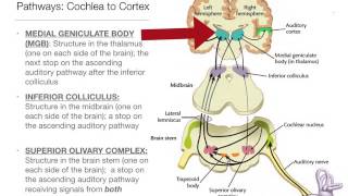 Perception101  The Auditory Brain [upl. by Eniawd]