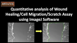 Quantitative analysis of Wound Healing Cell Migration or Scratch Assay using ImageJ Software [upl. by Kletter716]