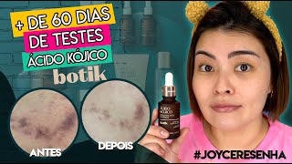 SÉRUM CLAREADOR DE ÁCIDO KÓJICO ✨ BOTIK✨ JoyceResenha [upl. by Renraw770]