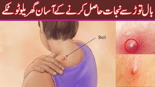 How To Get Rid Of Boils Overnight  Natural Treatment At Home  Bal Tor ka Ilaj [upl. by Dell]