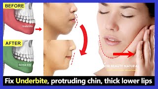 5 Exercises Fix Underbite without surgery fix protruding chin reduce thick lower lip [upl. by Arikat810]