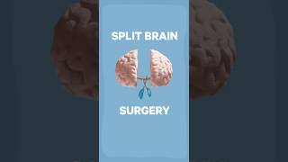 Can you split consciousness  science neuroscience experiment [upl. by Myo950]