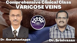 VARICOSE VEINS Clinical Case Presentation [upl. by Hewie]