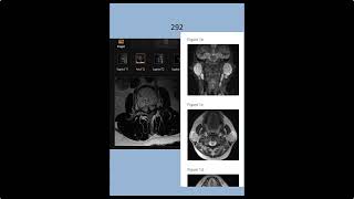 RADIOLOGY EXAM CASES [upl. by Aivatnahs]