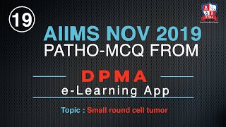 Small round blue cell tumor AIIMS Nov 2019 by Dr Devesh Mishra [upl. by Euqinomod]