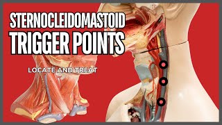 Understanding Trigger Points in the Sternocleidomastoid Muscle [upl. by Aurilia569]