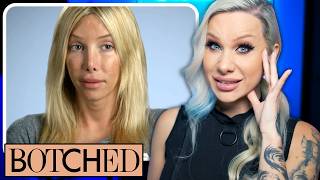 BOTCHED Is 24 trans plastic surgeries too many volume 3 [upl. by Stultz866]