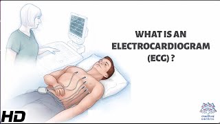 What Is An Electrocardiogram [upl. by Ahsirk]