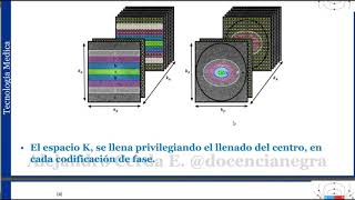 CLASE ANGIOGRAFIA CON CONTRASTE [upl. by Eceined]