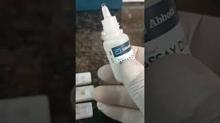 HIV HCV HBSAG Test Procedure by Kit laboratory pathology medicallaboratory lab labtechdt [upl. by Druci71]