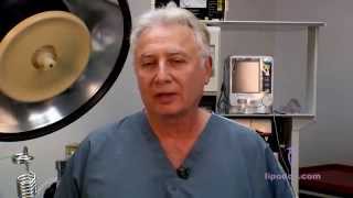 Laser Liposuction Dr Leon Forrester Tcheupdjian MD [upl. by Silvain]