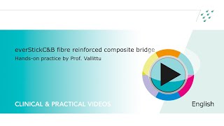 everStickCampB fibre reinforced composite bridge  handson by Prof Vallittu [upl. by Bor559]