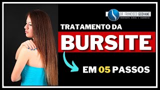 BURSITE SUBACROMIAL SUBDELTÓIDEA  Conheça o MELHOR MÉTODO para tratar a bursite em 05 PASSOS [upl. by Parrie341]