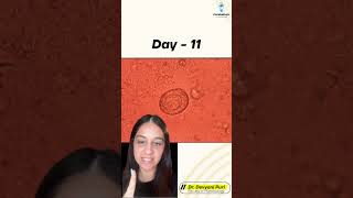 Welcome to today’s Micro Mystery  Can you crack this case  Day 11  Dr Devyani Puri [upl. by Eatton]