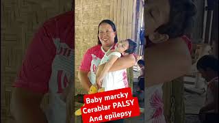 Cerablar PALSY and epilepsy baby🙏🙏🙏short [upl. by Gnof]