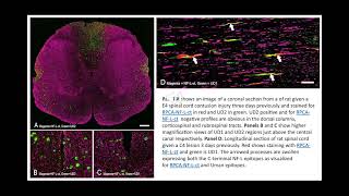 Uman type neurofilament light antibodies are effective reagents for the imaging of neurodegeneration [upl. by Norm808]