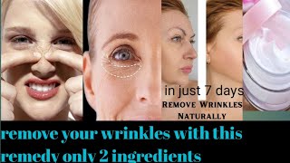 How to remove wrinkles naturallyanti aging creamanti wrinkles cream at homeremedy for wrinkles [upl. by Nioe]